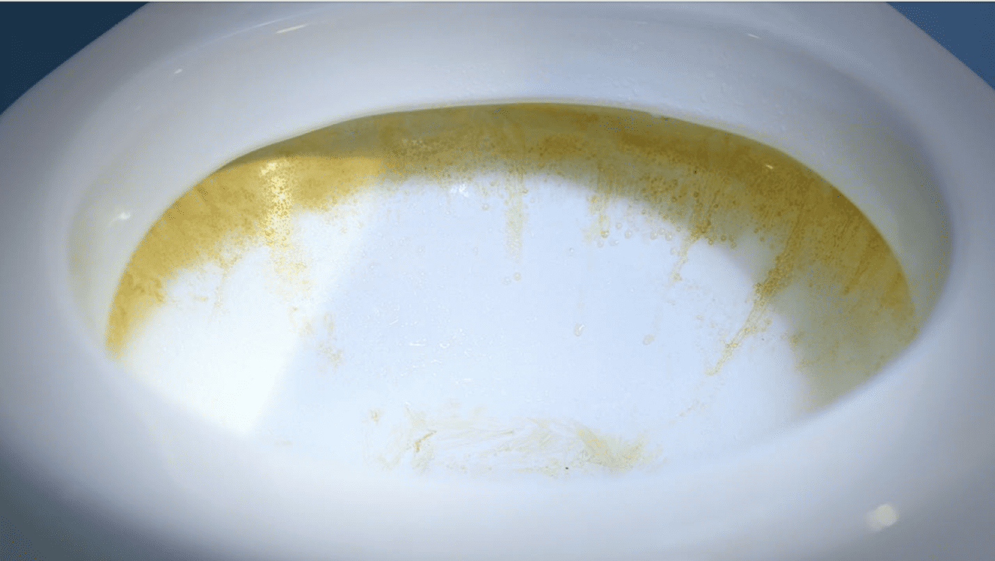 A white toilet bowl with brown stains Description automatically generated